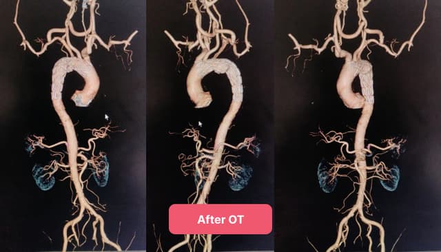 Advanced Vascular Success image after step 5