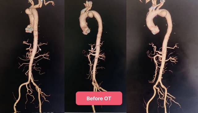Advanced Vascular Success image after step 1