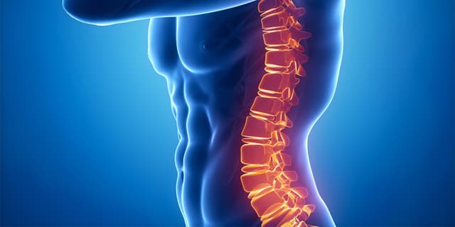 Complex Scoliosis Successfully Treated with Advanced Spine Care